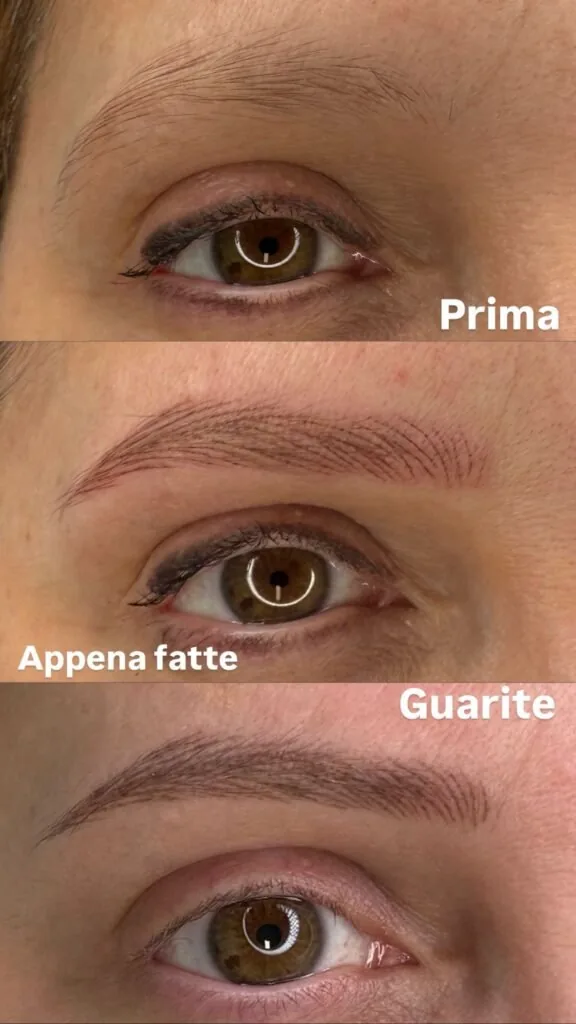 Sopracciglia prima, appena fatte e guarite